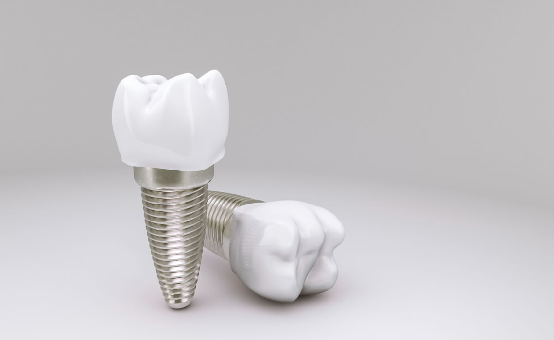 tek diş implant