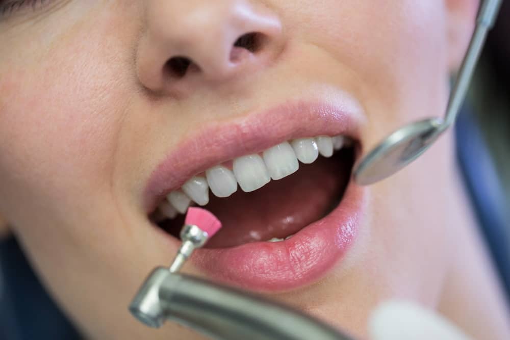 zirkonyum kaplama ve implant kron