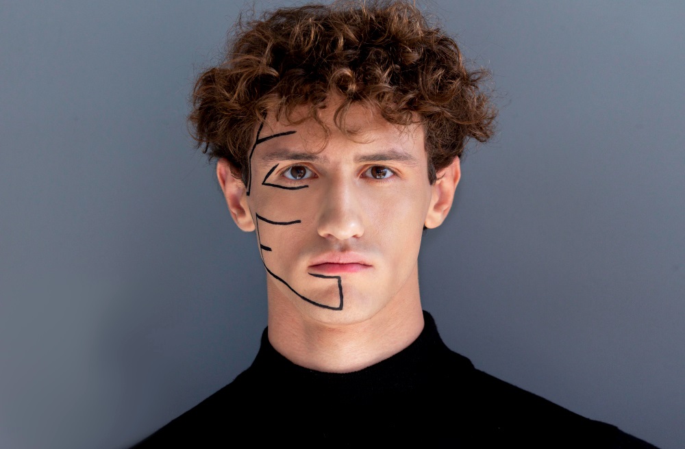 bruksizm kaynaklı yüz asimetrisi