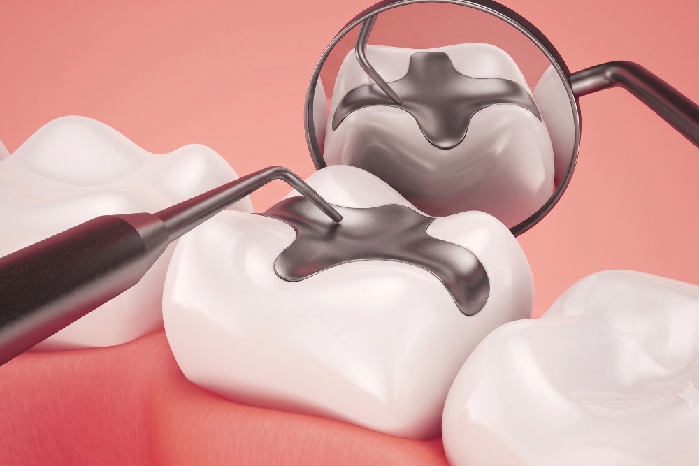 amalgam dolgu zararlı mıdır