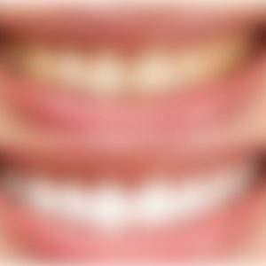 blur-estetik-anasayfa